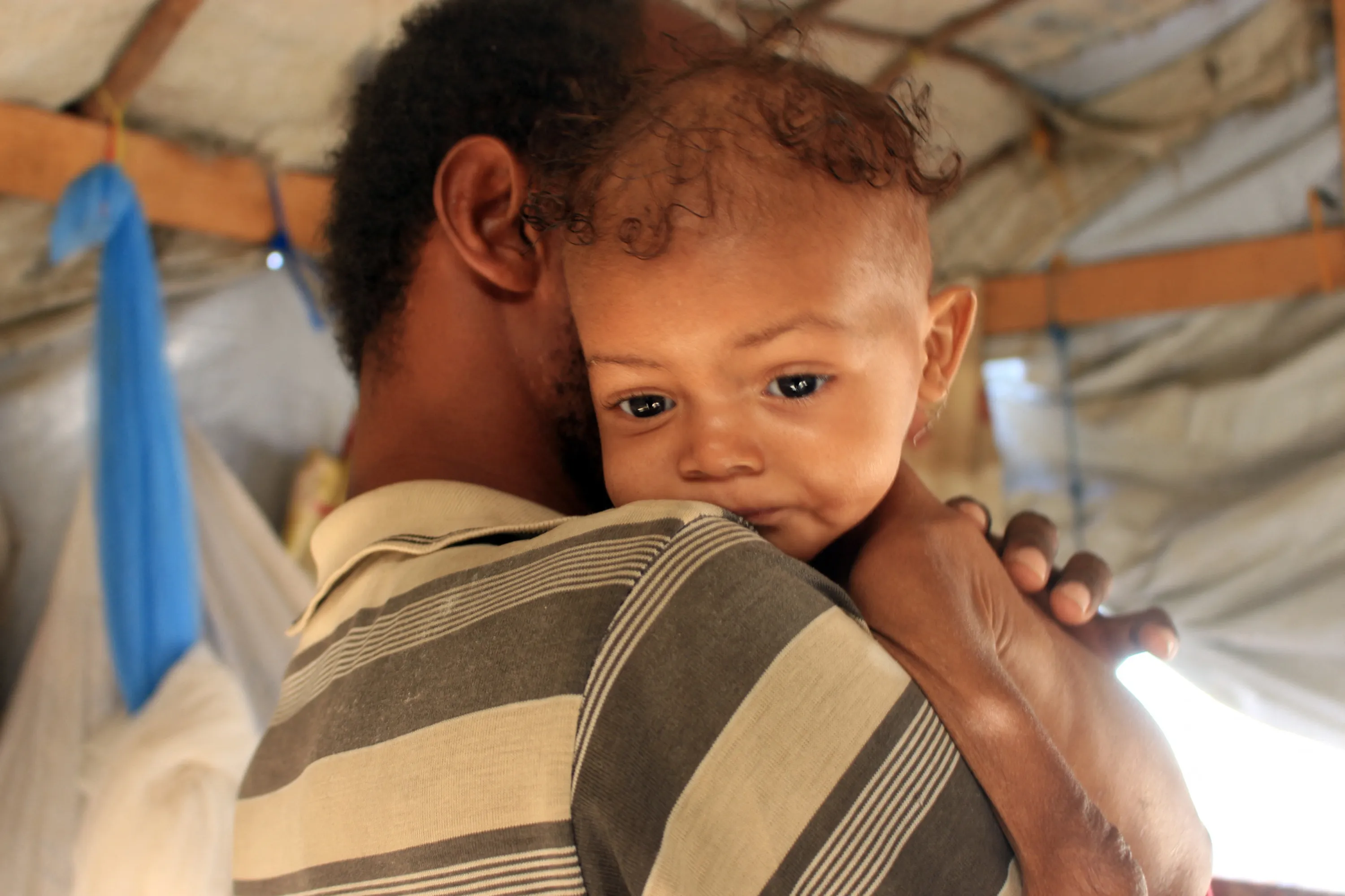 Randa Ali, una niña yemení de tres años que sufre desnutrición aguda grave, es llevada por su padre en el campamento de Al-Khudash para personas desplazadas en el distrito de Abs de la gobernación de Hajjah, en el noroeste de Yemen, el 19 de febrero de 2022.