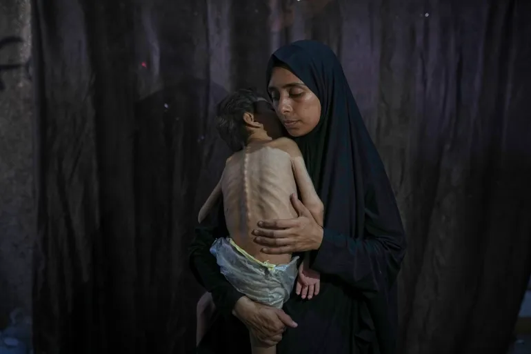 Samah Matar posa para una fotografía con su hijo Yousef, de 6 años, que sufre desnutrición y parálisis cerebral, en una escuela administrada por la ONU en la ciudad de Gaza, el sábado 26 de julio de 2025.