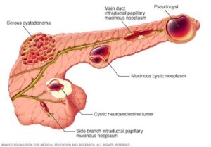 www.mayoclinic.org